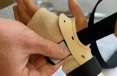 SPLINTING FOR WRIST AND HAND FRACTURES