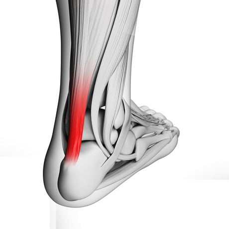 HOW PHYSICAL THERAPY CAN ALLEVIATE YOUR TENDON PROBLEMS